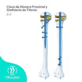 Clavo de Húmero Proximal y Diafisiario de Titanio
