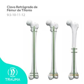 Clavo Retrógrado de Fémur de Titanio