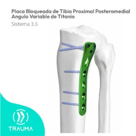 Placa Bloqueada de Tibia Proximal Posteromedial Angulo Variable de Titanio
