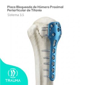 Placa Bloqueada de Húmero Proximal Periarticular de Titanio