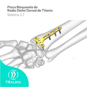 Placa Bloqueada de Radio Distal Dorsal de Titanio