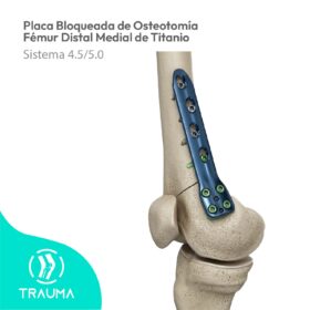 Placa Bloqueada de Osteotomía Fémur Distal Medial de Titanio