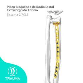 Placa Bloqueada de Radio Distal Extralarga de Titanio