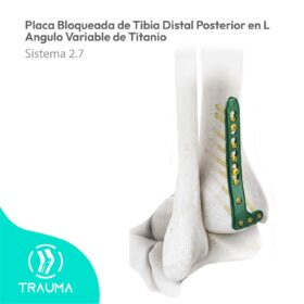 Placa Bloqueada de Tibia Distal Posterior en L Angulo Variable de Titanio