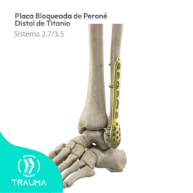 Placa Bloqueada de Peroné Distal de Titanio