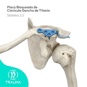 Placa Bloqueada de Clavícula Gancho de Titanio